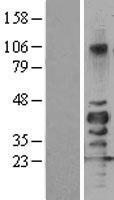 SIRT7 Human Over-expression Lysate