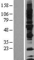 Glycoprotein VI (GP6) Human Over-expression Lysate