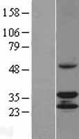 TACO1 Human Over-expression Lysate
