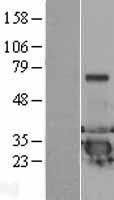 DCXR Human Over-expression Lysate