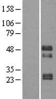 TOB2 Human Over-expression Lysate