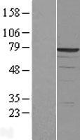 DDX41 Human Over-expression Lysate