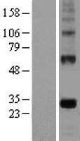 EGFL7 Human Over-expression Lysate