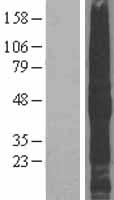 TMEFF2 Human Over-expression Lysate