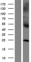 CLECSF6 (CLEC4A) Human Over-expression Lysate