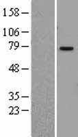 PIAS1 Human Over-expression Lysate