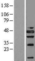 NSFL1C Human Over-expression Lysate