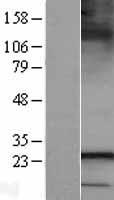 SAR1B Human Over-expression Lysate