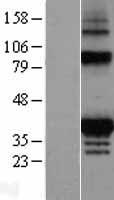 FAHD2A Human Over-expression Lysate