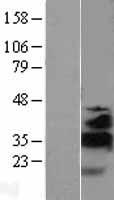 KLF13 Human Over-expression Lysate