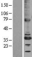 TMX2 Human Over-expression Lysate