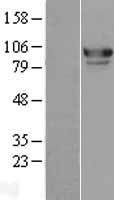 MED15 Human Over-expression Lysate