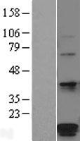 HSPC014 (POMP) Human Over-expression Lysate