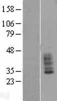 SLC14A1 Human Over-expression Lysate