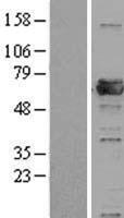 PRPF31 Human Over-expression Lysate