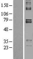 PTCD1 Human Over-expression Lysate