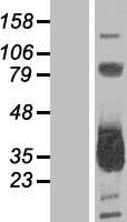 MMACHC Human Over-expression Lysate