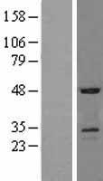 SOSTDC1 Human Over-expression Lysate