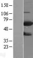 MTMR9 Human Over-expression Lysate