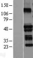 TRIM58 Human Over-expression Lysate
