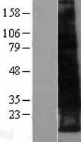 LEPROTL1 Human Over-expression Lysate