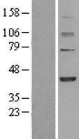 FBXO28 Human Over-expression Lysate