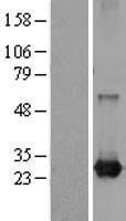 RAB21 Human Over-expression Lysate