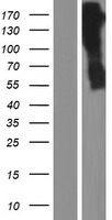 ARSG Human Over-expression Lysate
