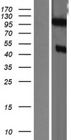 DZIP1 Human Over-expression Lysate