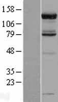 PAN2 Human Over-expression Lysate