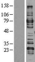 ARHGAP25 Human Over-expression Lysate