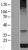 TOMM20 Human Over-expression Lysate