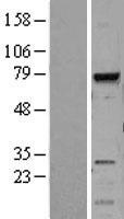 MELK Human Over-expression Lysate