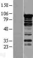MRPL19 Human Over-expression Lysate