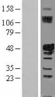 IST1 Human Over-expression Lysate