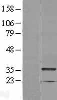 MAD2L1 binding protein (MAD2L1BP) Human Over-expression Lysate