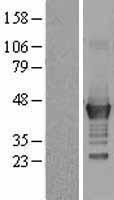 LMCD1 Human Over-expression Lysate