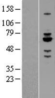 Rabex5 (RABGEF1) Human Over-expression Lysate
