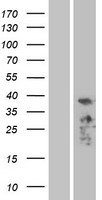 ALP (PDLIM3) Human Over-expression Lysate