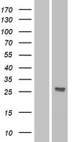 DKK2 Human Over-expression Lysate