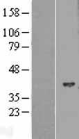 HIBCH Human Over-expression Lysate