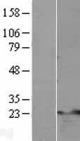 TNFAIP8 Human Over-expression Lysate