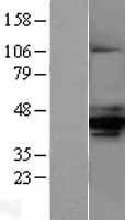 AMACR Human Over-expression Lysate