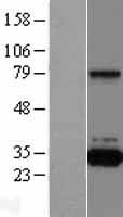 QPRT Human Over-expression Lysate