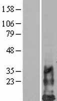 HCST Human Over-expression Lysate