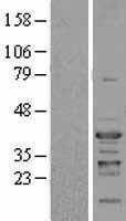 NFYC Human Over-expression Lysate