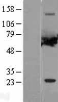 PPP2R1A Human Over-expression Lysate