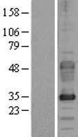 Dysadherin (FXYD5) Human Over-expression Lysate