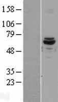 ACAD9 Human Over-expression Lysate