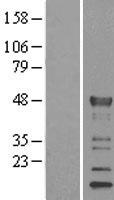 KLF15 Human Over-expression Lysate